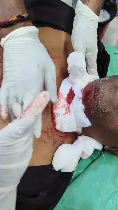 ప్రాణాంతకమైన చైనా మాంజా.. వరంగల్ హైవేపై కారు అద్దం కట్!